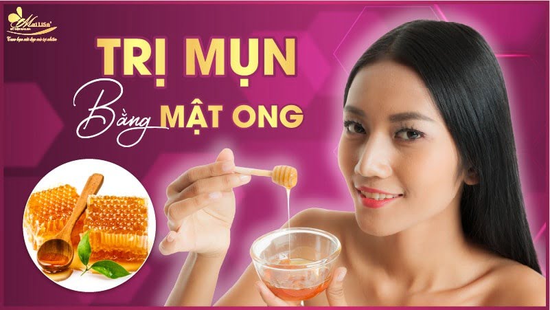 cách trị mụn tại nhà