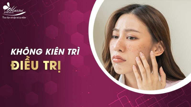 trị nám bằng dầu dừa