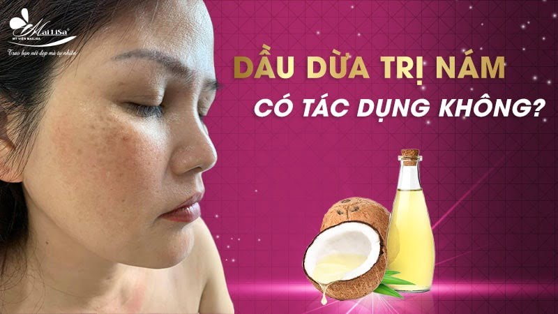 trị nám bằng dầu dừa