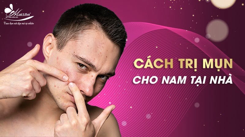 cách trị mụn cho nam