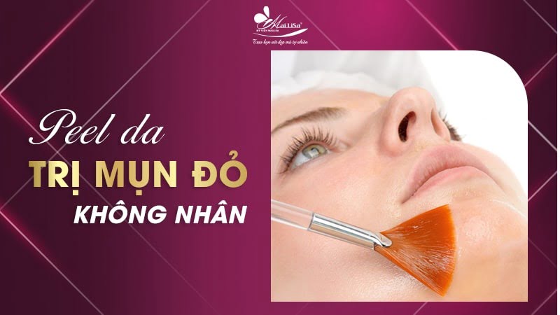 mụn đỏ không nhân