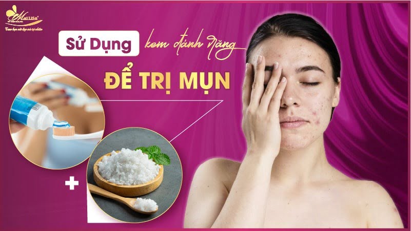 cách trị mụn tại nhà