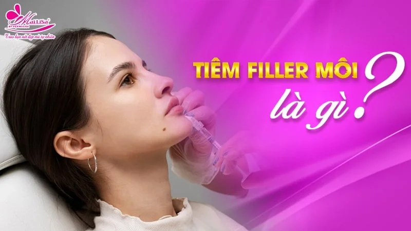 4. Đối tượng phù hợp để tiêm filler môi