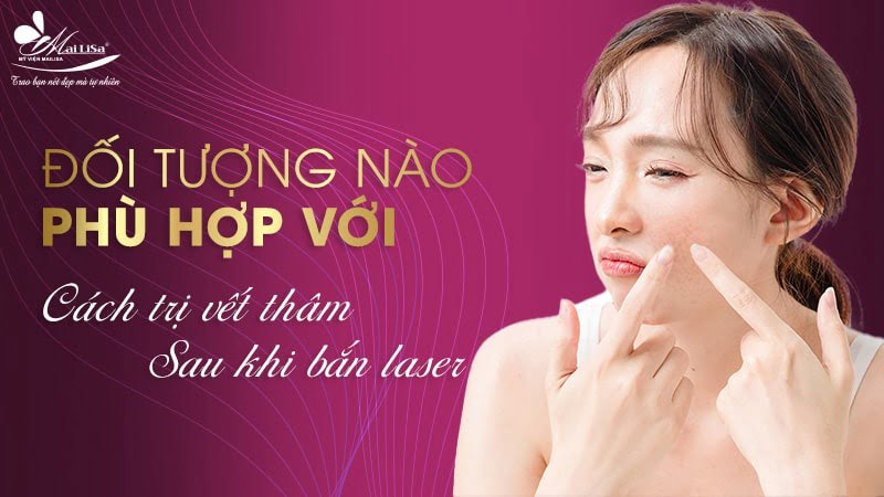 cách trị vết thâm sau khi bắn laser