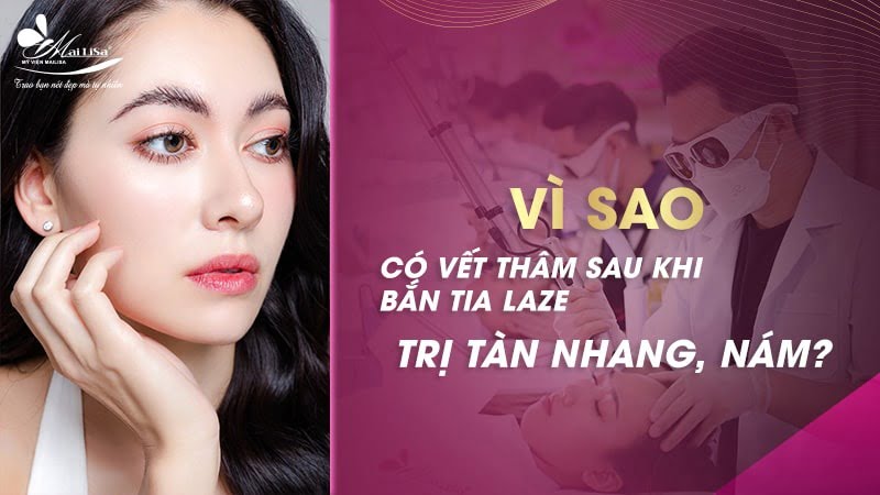 cách trị vết thâm sau khi bắn laser