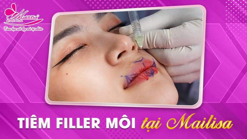 moi-tiem-filler