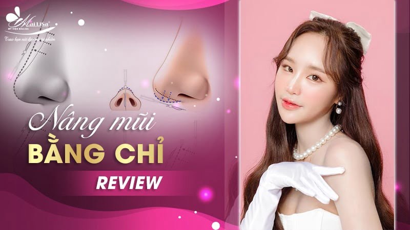 nâng mũi bằng chỉ review