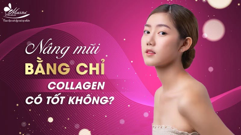 nâng mũi bằng chỉ review