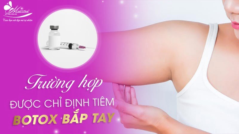 tiêm botox bắp tay