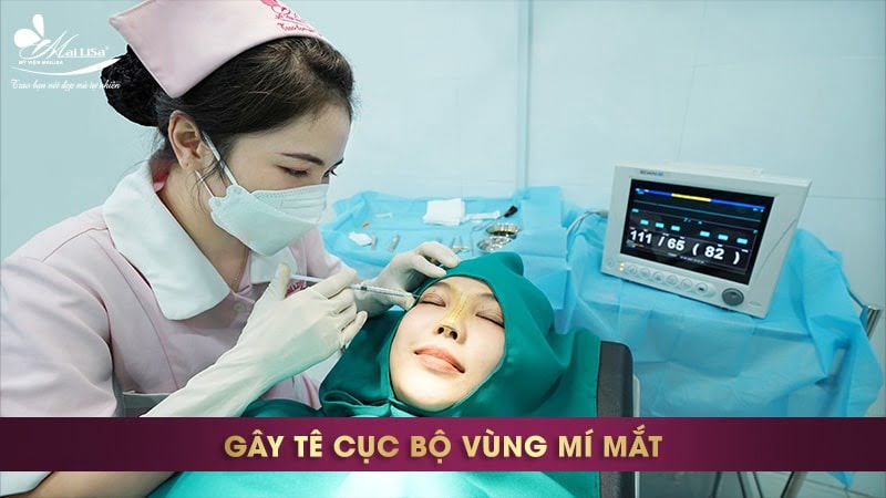 cắt mí ấn độ