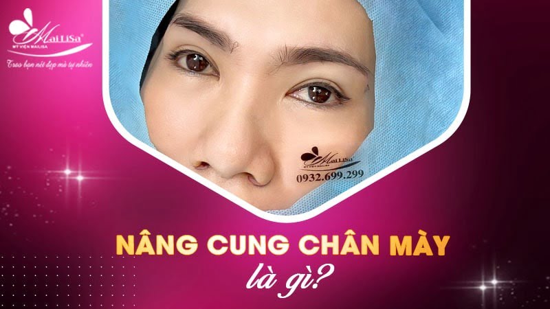 tác dụng của nâng cung chân mày