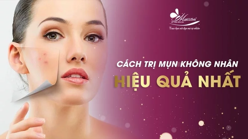 mụn đỏ không nhân