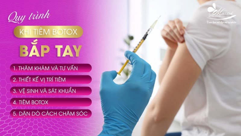 tiêm botox bắp tay