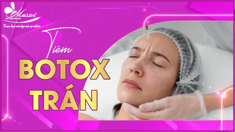 botox xoá nhăn