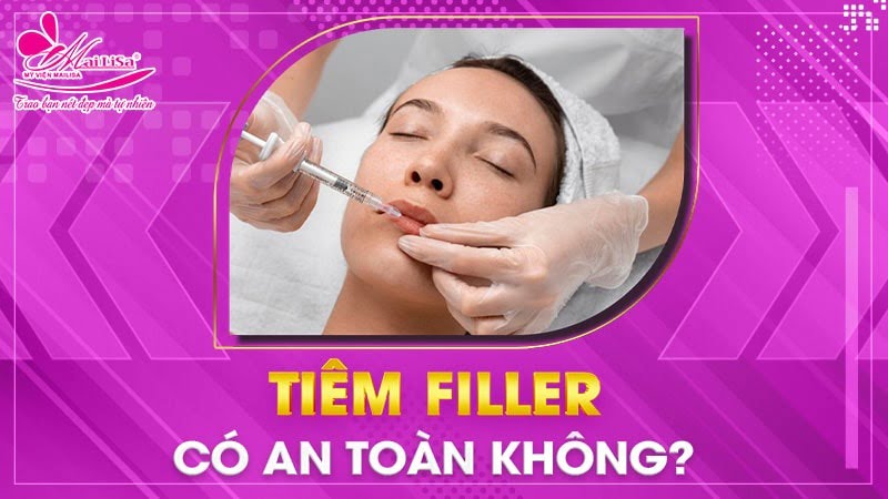 tiem-filler-co-an-toan-khong