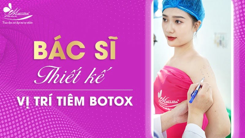 tiêm botox bắp tay