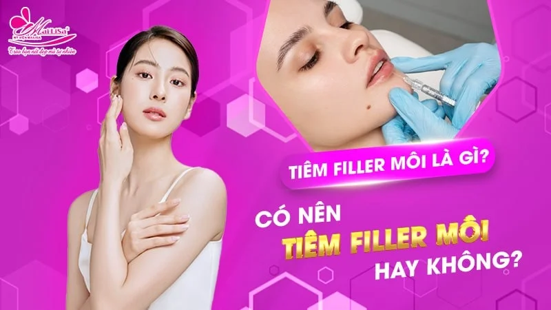 Thời gian kiêng ăn sau tiêm filler môi