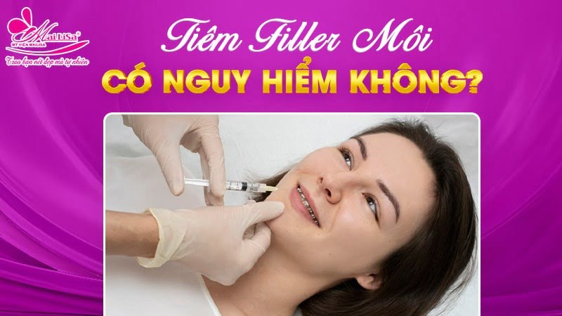 tiem-filler-moi