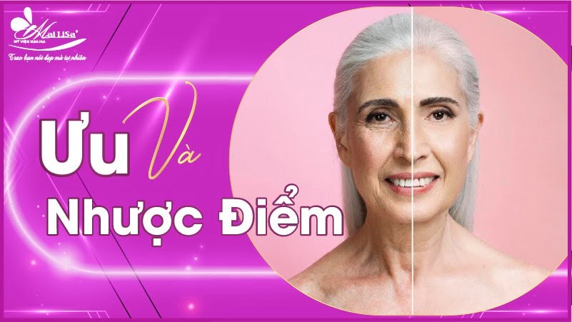 botox xoá nhăn