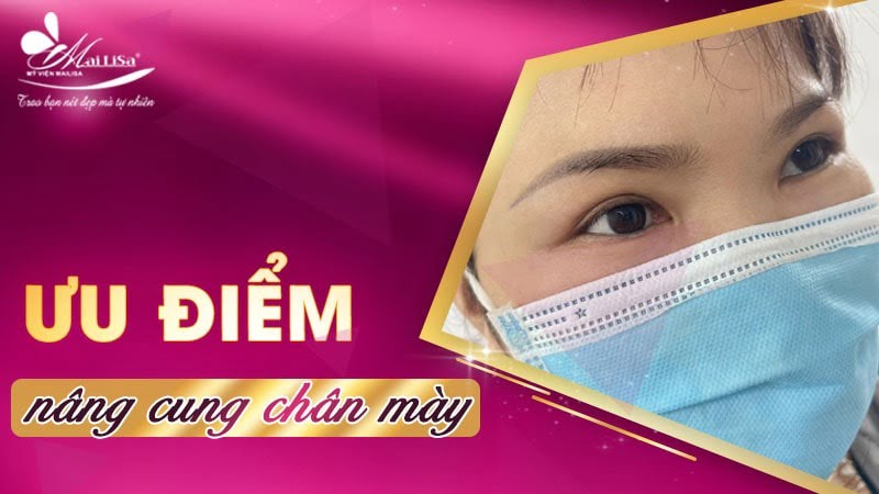 tác dụng của nâng cung chân mày