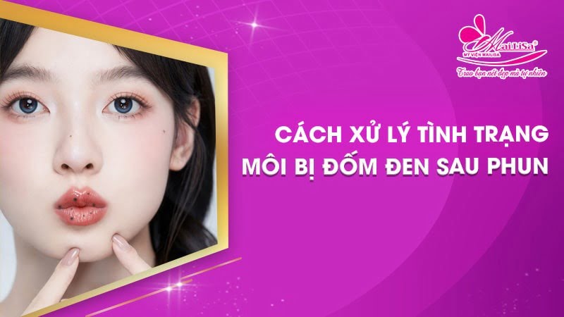 phun môi bị đốm đen