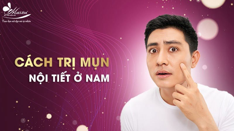 cách trị mụn cho nam