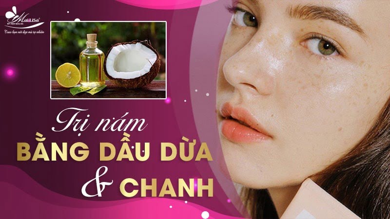 chữa tàn nhang bằng dầu dừa