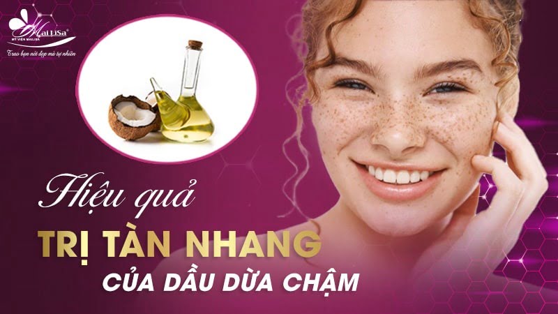 chữa tàn nhang bằng dầu dừa