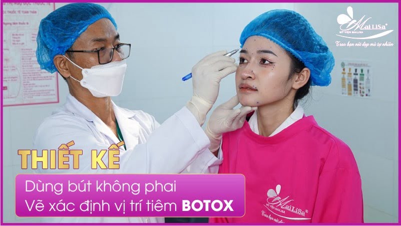 ai-khong-nen-tiem-botox