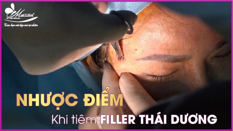 filler-thai-duong