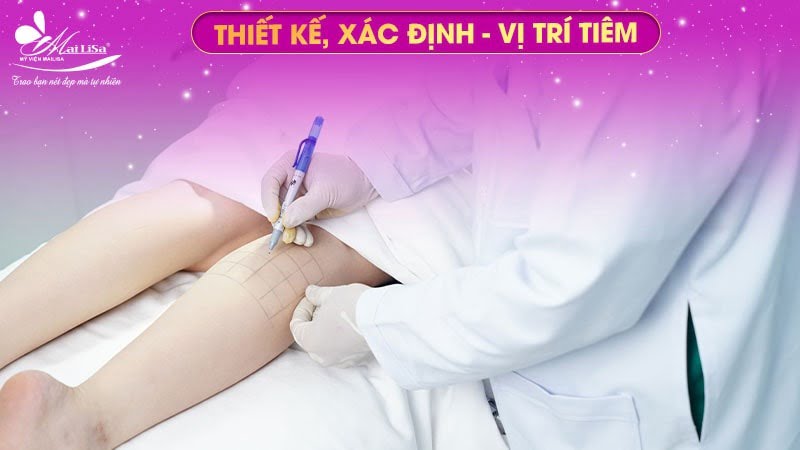 gia-tiem-botox