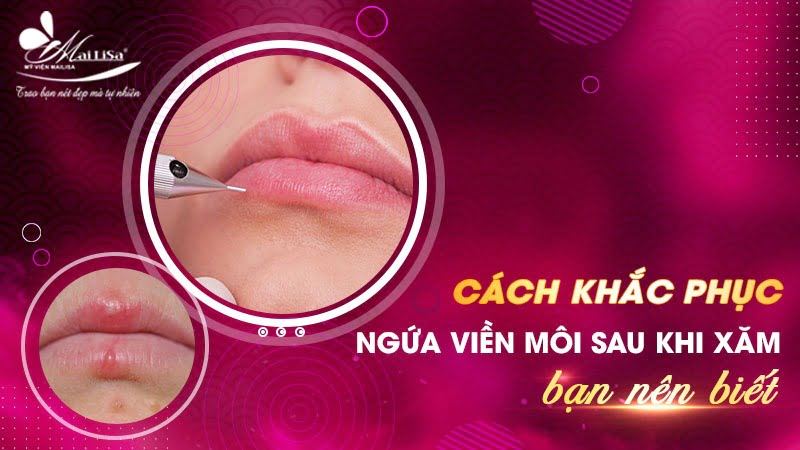 ngứa viên môi sau khi xăm