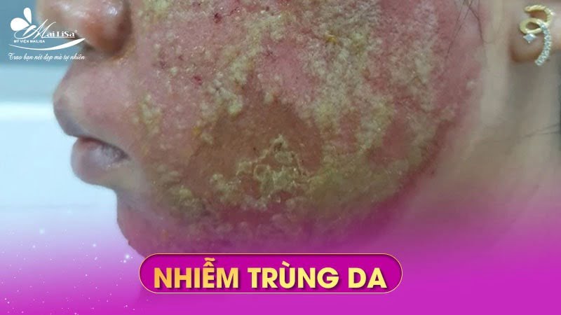 tiem-botox-co-nguy-hiem-khong