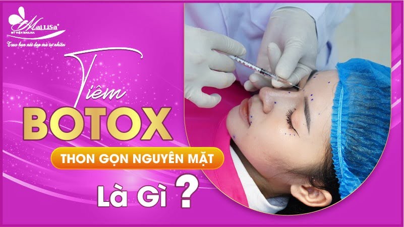 tiem-botox-gon-mat-la-gi