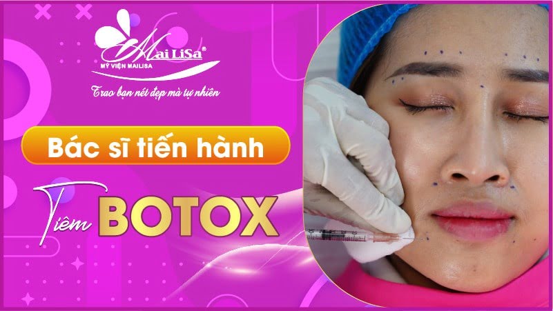 tiem-botox-moi