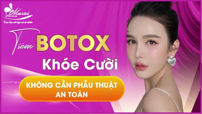 tiem-botox-ranh-cuoi-co-tot-khong