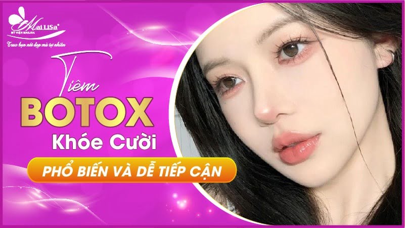 tiem-botox-ranh-cuoi