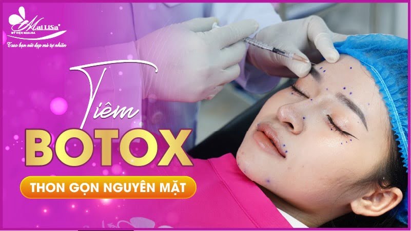 tiem-botox-thon-gon-mat