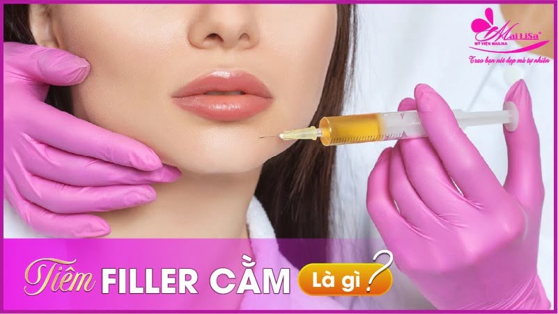 tiem-filler-cam-gia-bao-nhieu