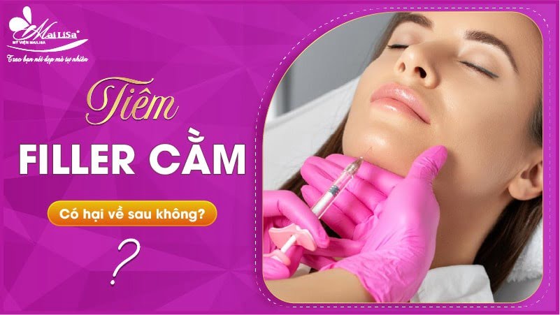 tiem-filler-cam-kieng-gi