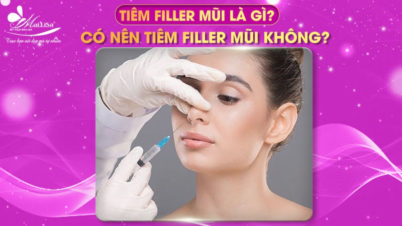 Tiêm filler mũi