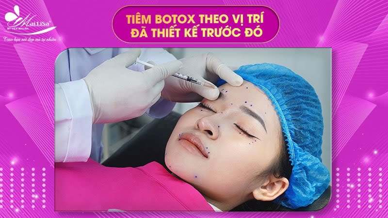 tiem-botox-gon-ham-gia-bao-nhieu