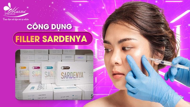 cong-dung-filler-sardenya