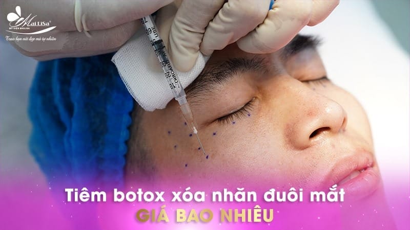 botox-beautem