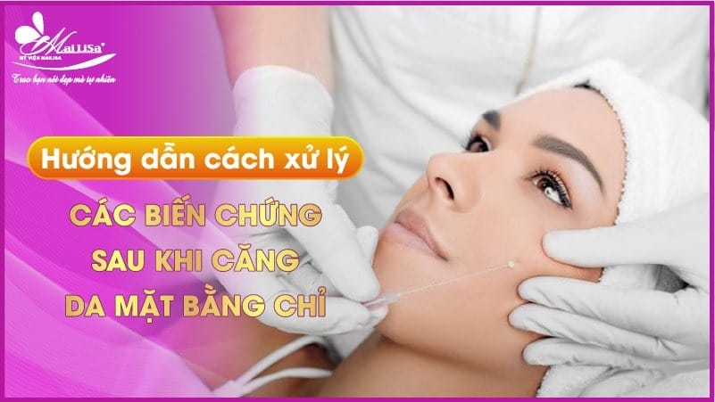 cang-chi-collagen-co-tot-khong