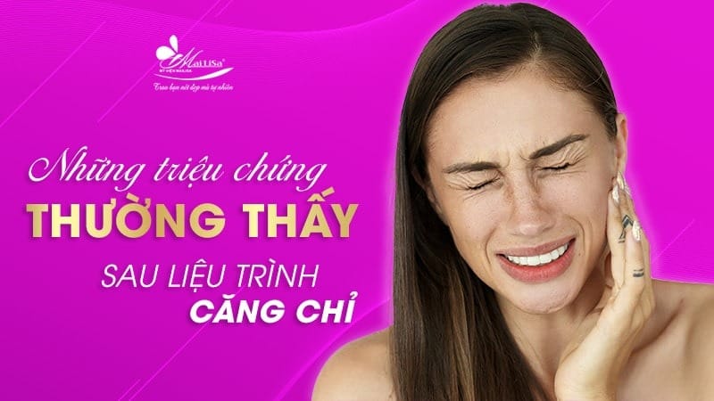 nhuoc-diem-cua-cang-chi-collagen