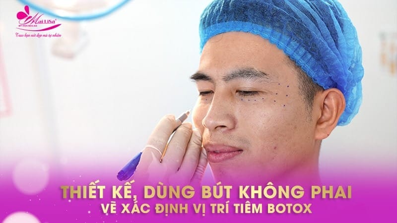 tiem-botox-tri-hoi-nach-gia-bao-nhieu