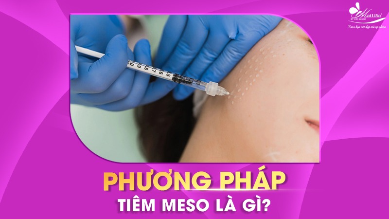 phuong-phap-tiem-meso