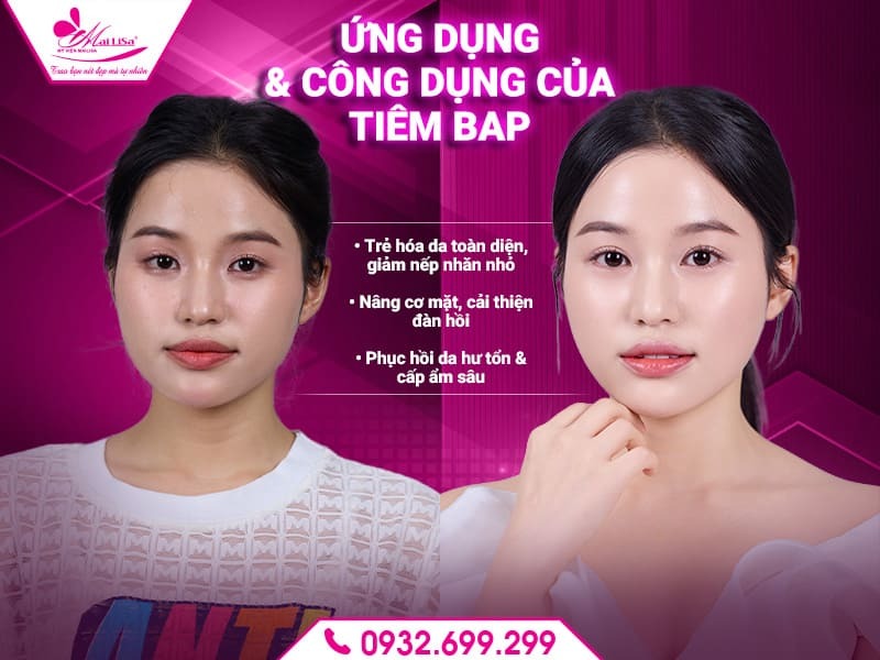 tiem-bap-5-diem-la-gi