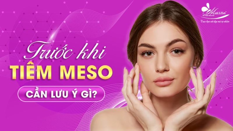 co-nen-tiem-meso